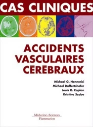 Accidents vasculaires cérébraux. Formes cliniques habituelles et inhabituelles