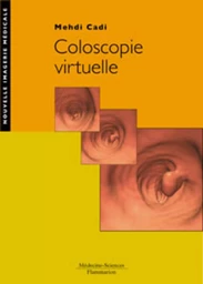 Coloscopie virtuelle