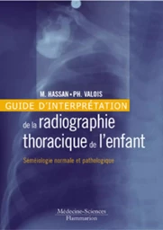 Guide d'interprétation de la radiographie thoracique de l'enfant : séméiologie normale et pathologique