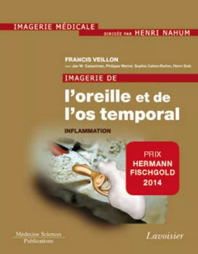 Imagerie de l'oreille et de l'os temporal - Volume 2. Inflammation - Henri NAHUM, Jan W. CASSELMAN, Francis VEILLON - MEDECINE SCIENC