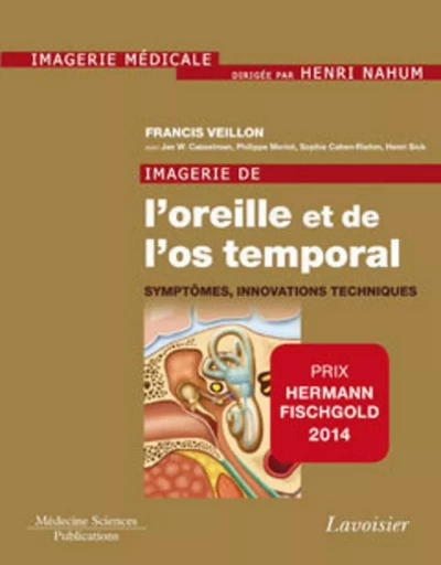 Imagerie de l'oreille et de l'os temporal - Volume 6. Symptômes, innovations techniques - Henri NAHUM, Jan W. CASSELMAN, Francis VEILLON - MEDECINE SCIENC