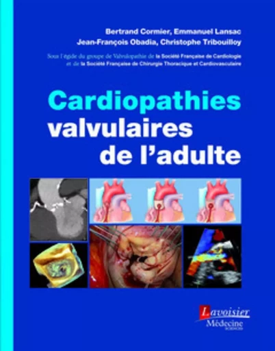 Cardiopathies valvulaires de l'adulte - Jean-François OBADIA, Emmanuel LANSAC, Bertrand CORMIER - MEDECINE SCIENC