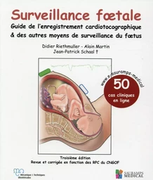 SURVEILLANCE FOETALE - GUIDE DE L'ENREGISTREMENT CARDIOTOCOGRAPHIQUE & AUTRES MO