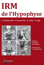 IRM DE L HYPOPHYSE