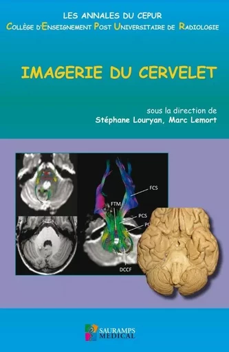 IMAGERIE DU CERVELET - Stéphane Louryan, Marc Lemort - SAURAMPS MEDICA