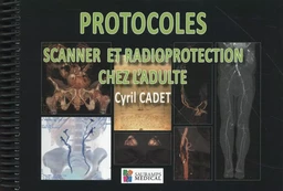 PROTOCOLES SCANNER ET RADIOPROTECTION CHEZ L ADULTE