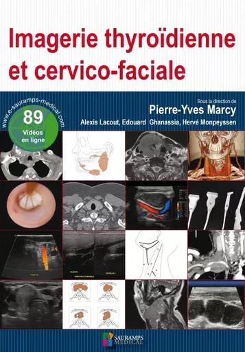 IMAGERIE THYROIDIENNE ET CERVICO-FACIALE - Pierre-Yves Marcy - SAURAMPS MEDICA