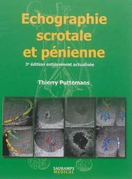 ECHOGRAPHIE SCROTALE ET PENIENNE