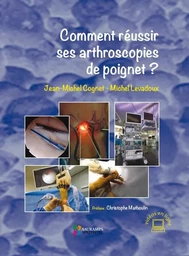 COMMENT REUSSIR SES ARTHROSCOPIES DE POIGNET ?