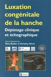 LUXATION CONGENITALE DE LA HANCHE. DEPISTAGE CLINIQUE ET ECHOGRAPHIQUE