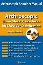 SHOULDER CONCEPTS BON BLOCK PROCEDURES FOR SHOULDER STABILIZATION