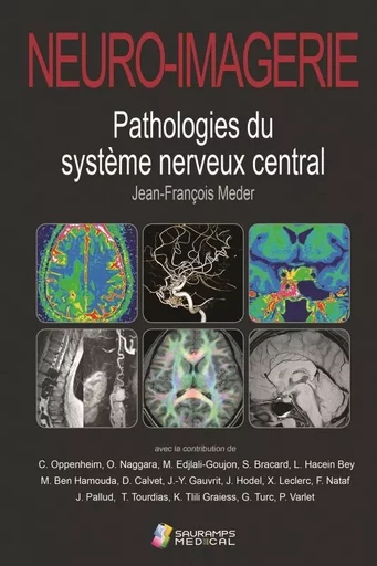 NEURO-IMAGERIE. PATHOLOGIES DU SYSTEME NERVEUX CENTRAL 2ED - Jean-François Meder - SAURAMPS MEDICA