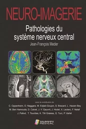 NEURO-IMAGERIE. PATHOLOGIES DU SYSTEME NERVEUX CENTRAL 2ED