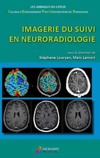 IMAGERIE DU SUIVI EN NEURORADIOLOGIE -  Collège d'enseignement post-universitaire de radiologie, Marc Lemort, Stéphane Louryan - SAURAMPS MEDICA