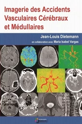 IMAGERIE DES ACCIDENTS VASCULAIRES CEREBRAUX ET MEDULLAIRES