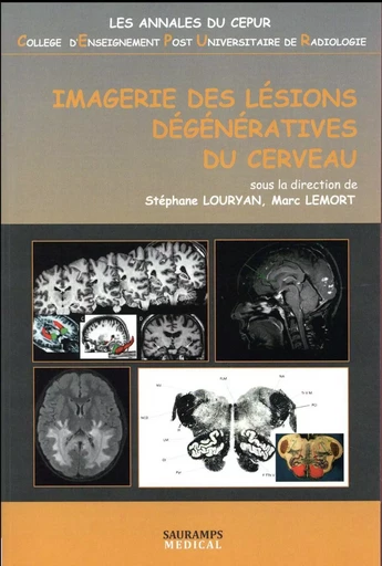 IMAGERIE DES LESIONS DEGENERATIVES DU CERVEAU - LELORT MARC LOURYAN STEPHANE - SAURAMPS MEDICA