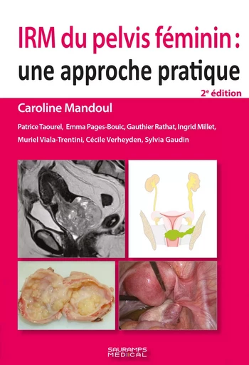 IRM du pelvis féminin 2e ED - Caroline Mandoul, Patrice Taourel - SAURAMPS MEDICA