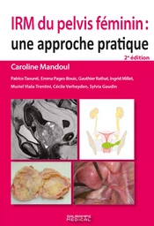 IRM du pelvis féminin 2e ED