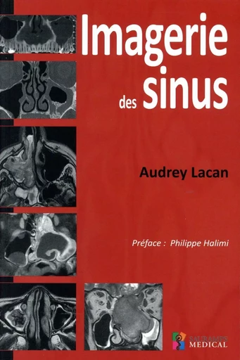 IMAGERIE DES SINUS - Audrey Lacan - SAURAMPS MEDICA