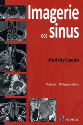 IMAGERIE DES SINUS