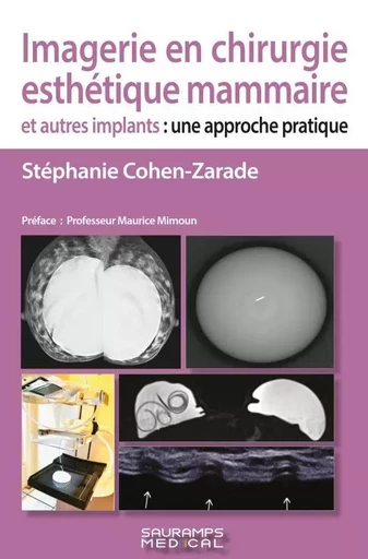 Imagerie en chirurgie esthétique mammaire et autres implants -  COHEN-ZARADE STEPHANIE - SAURAMPS MEDICA