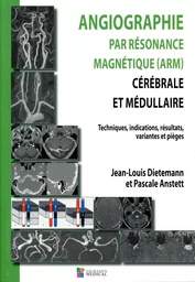 ANGIOGRAPHIE PAR RESONANCE MAGNETIQUE (ARM) CEREBRALE ET MEDULLAIRE