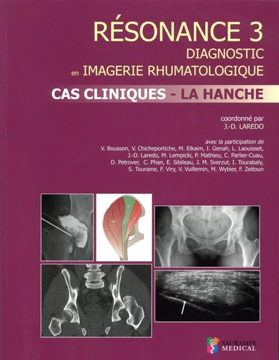 RESONANCE 3 CAS CLINIQUES- LA HANCHE -  LAREDO JEAN-DENIS - SAURAMPS MEDICA