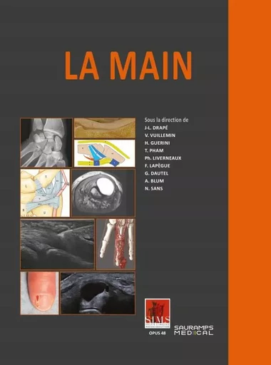 LA MAIN. SIMS -  DRAPE/VUILLEMIN & COLL - SAURAMPS MEDICA