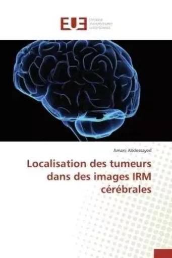 Localisation des tumeurs dans des images irm cérébrales -  ABDESSAYED-A - UNIV EUROPEENNE