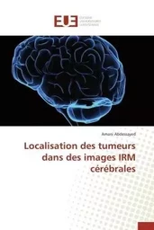 Localisation des tumeurs dans des images irm cérébrales