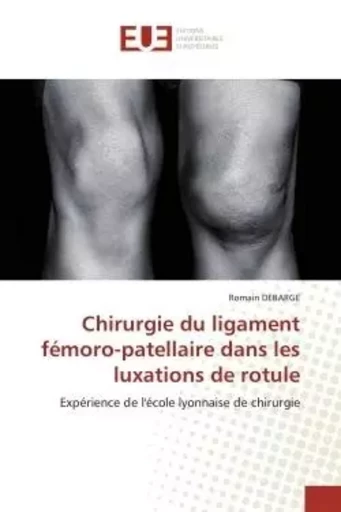 Chirurgie du ligament fémoro-patellaire dans les luxations de rotule - Romain DEBARGE - UNIV EUROPEENNE