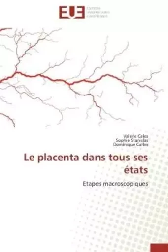 Le placenta dans tous ses états - Valerie Cales, Sophie Stanislas, Dominique Carles - UNIV EUROPEENNE