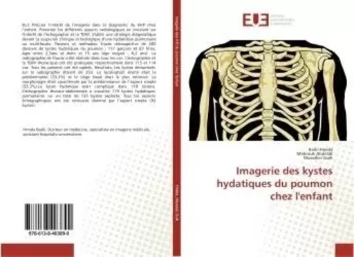 Imagerie des kystes hydatiques du poumon chez l'enfant - Badii Hmida - UNIV EUROPEENNE