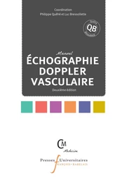 Échographie doppler vasculaire