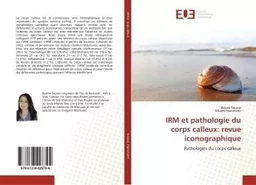 IRM et pathologie du corps calleux: revue iconographique