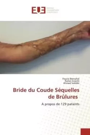 Bride du Coude Séquelles de Brûlures - Fouzia Benrahal, Ramzi Graichi, Ahmed SEDDIKI - UNIV EUROPEENNE