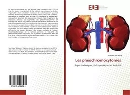 Les phéochromocytomes