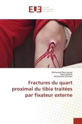 Fractures du quart proximal du tibia traitées par fixateur externe - Mohamed Ben Jemaa, Sami Sellami, Mohamed Ghorbel - UNIV EUROPEENNE