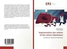 Segmentation des artères et des veines hépatiques