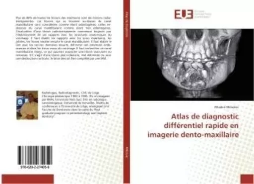 Atlas de diagnostic différentiel rapide en imagerie dento-maxillaire - Mladen Milicevic - UNIV EUROPEENNE