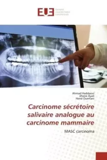 Carcinome sécrétoire salivaire analogue au carcinome mammaire - Ahmad Haddaoui, Jihene Ayari, Hend Ouertani - UNIV EUROPEENNE