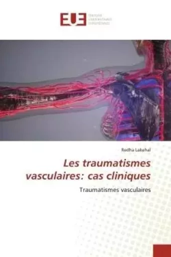 Les traumatismes vasculaires: cas cliniques - Redha Lakehal - UNIV EUROPEENNE