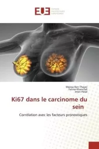 Ki67 dans le carcinome du sein - Maissa Ben Thayer, Fatma khanchel, Imen Helal - UNIV EUROPEENNE