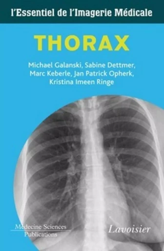 Thorax - Marc KEBERLE, Sabine DETTMER, Michael GALANSKI - MEDECINE SCIENC