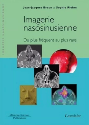 Imagerie nasosinusienne - Sophie RIEHM, Jean-Jacques BRAUN - MEDECINE SCIENC