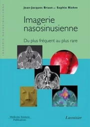 Imagerie nasosinusienne