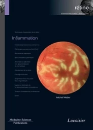 Inflammation (volume 4 - coffret Rétine)