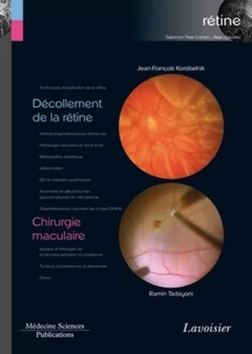 Décollement de la rétine / Chirurgie maculaire (volume 6 - coffret Rétine) - Franck FAJNKUCHEN, Ramin Tadayoni, Jean-François Korobelnik - MEDECINE SCIENC