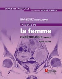 Imagerie de la femme : Gynécologie - Tome 2