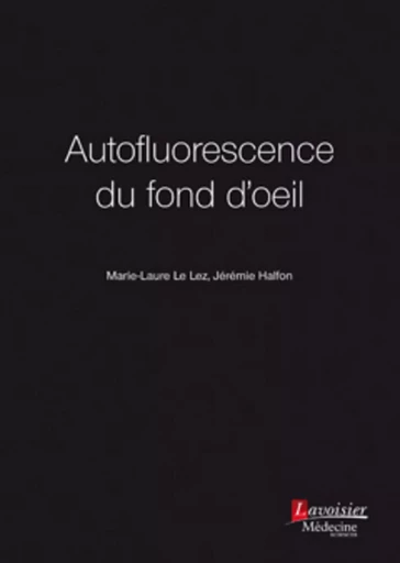 Autofluorescence du fond d'oeil - Salomon-Yves COHEN, Jérémie HALFON, LEZ Marie-Laure LE - MEDECINE SCIENC